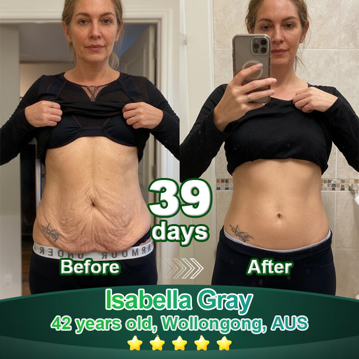 Awzlove® Luxurious Collagen & Stem Cell Anti-Cellulite Massage Oil (🔥70% Off for a Limited Time!)🫚🫚