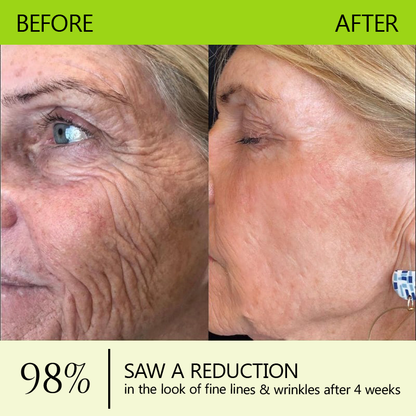 𝗛𝗲𝗮𝗹𝗿𝗶𝘇𝗲® 𝗕𝗼𝘁𝗼𝘅 & 𝗩𝗶𝘁𝗮-𝗔 𝗥𝗲𝘁𝗶𝗻𝗼𝗹 𝗦𝗵𝗼𝘁 𝗪𝗿𝗶𝗻𝗸𝗹𝗲-𝗟𝗶𝗳𝘁 𝗧𝗶𝗴𝗵𝘁𝗲𝗻𝗶𝗻𝗴 𝗰𝗿𝗲𝗮𝗺 - 𝗟𝗮𝘀𝘁 𝗗𝗮𝘆 𝗣𝗿𝗼𝗺𝗼𝘁𝗶𝗼𝗻 𝟴𝟬% 𝗢𝗙𝗙 |🌾🐳 𝗠𝗮𝗱𝗲 𝗮𝗻𝗱 𝘀𝗵𝗶𝗽𝗽𝗲𝗱 𝗳𝗿𝗼𝗺 AU