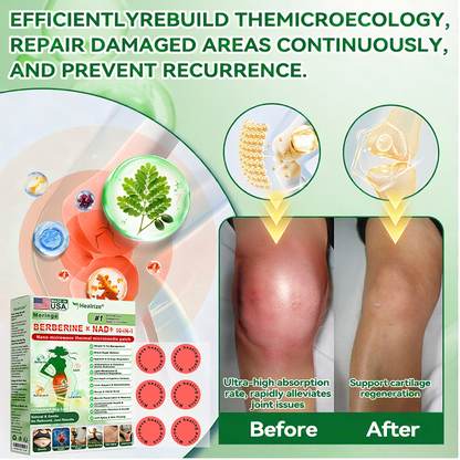 𝑶𝒇𝒇𝒊𝒄𝒊𝒂𝒍 𝑺𝒕𝒐𝒓𝒆  | 🩹👨‍⚕️Healrize®𝑴𝒐𝒓𝒊𝒏𝒈𝗮 · 𝗕𝗲𝗿𝗯𝗲𝗿𝙞𝙣𝙚 × 𝙉𝘼𝐃+ 𝟏𝟎-𝐢𝐧-𝟏 𝗔𝗱𝘃𝗮𝗻𝗰𝙚𝙙 Nano Microwave Thermal Metabolic Patch(𝐉𝐮𝐬𝐭 𝐨𝐧𝐜𝐞 𝐚 𝐝𝐚𝐲, 𝐯𝐢𝐬𝐢𝐛𝐥𝐞 𝐜𝐡𝐚𝐧𝐠𝐞𝐬 𝐢𝐧 𝟕 𝐝𝐚𝐲𝐬） ✅ 𝐅𝐨𝐫 𝐨𝐛𝐞𝐬𝐢𝐭𝐲, 🅛🅞🅞🅢🅔 🅢🅚🅘🅝,𝐝𝐢𝐚𝐛𝐞𝐭𝐞𝐬, 𝐬𝐥𝐞𝐞𝐩 𝐚𝐩𝐧𝐞𝐚, 𝐣𝐨𝐢𝐧𝐭 𝐢𝐬𝐬𝐮𝐞𝐬, 𝐚𝐧𝐝 𝐦𝐨𝐫𝐞 ❤👑