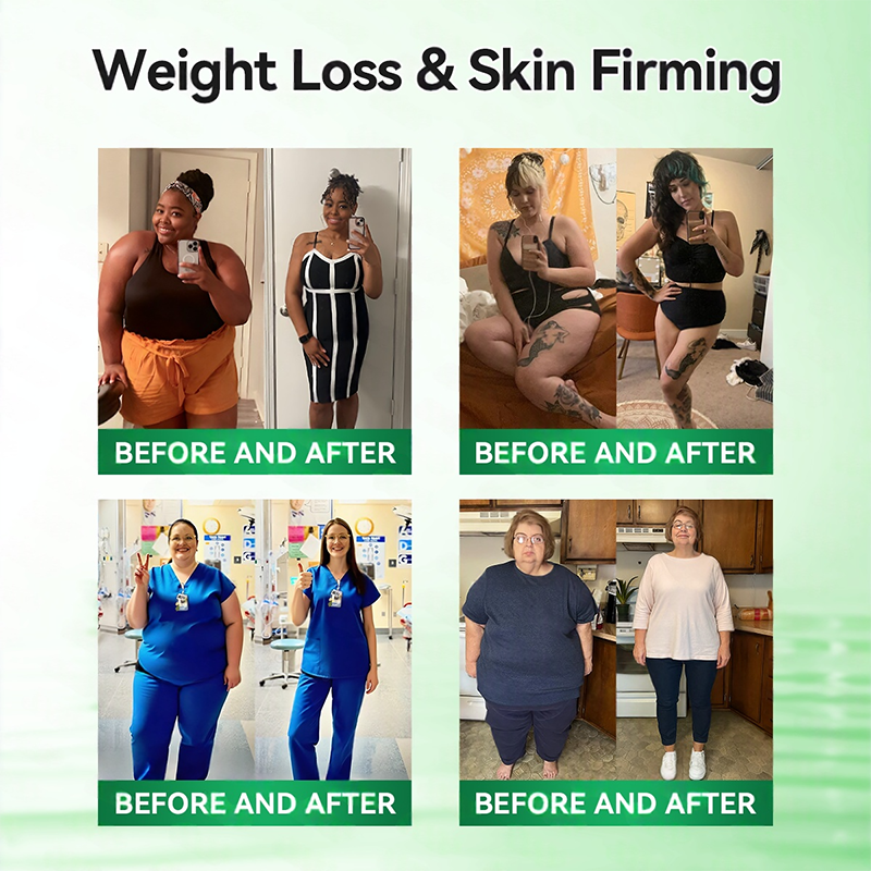 𝑶𝒇𝒇𝒊𝒄𝒊𝒂𝒍 𝑺𝒕𝒐𝒓𝒆  | 🩹👨‍⚕️Healrize®𝑴𝒐𝒓𝒊𝒏𝒈𝗮 · 𝗕𝗲𝗿𝗯𝗲𝗿𝙞𝙣𝙚 × 𝙉𝘼𝐃+ 𝟏𝟎-𝐢𝐧-𝟏 𝗔𝗱𝘃𝗮𝗻𝗰𝙚𝙙 Nano Microwave Thermal Metabolic Patch(𝐉𝐮𝐬𝐭 𝐨𝐧𝐜𝐞 𝐚 𝐝𝐚𝐲, 𝐯𝐢𝐬𝐢𝐛𝐥𝐞 𝐜𝐡𝐚𝐧𝐠𝐞𝐬 𝐢𝐧 𝟕 𝐝𝐚𝐲𝐬） ✅ 𝐅𝐨𝐫 𝐨𝐛𝐞𝐬𝐢𝐭𝐲, 🅛🅞🅞🅢🅔 🅢🅚🅘🅝,𝐝𝐢𝐚𝐛𝐞𝐭𝐞𝐬, 𝐬𝐥𝐞𝐞𝐩 𝐚𝐩𝐧𝐞𝐚, 𝐣𝐨𝐢𝐧𝐭 𝐢𝐬𝐬𝐮𝐞𝐬, 𝐚𝐧𝐝 𝐦𝐨𝐫𝐞 ❤👑