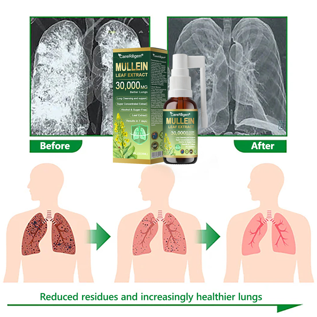 Enjoy 30% OFF for adding the second one |  CareRegen® 🫁