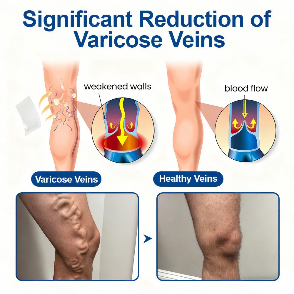 🇦🇺👨‍⚕️👍✅Healrize® VeinTarget Microneedle Patch⚡Instant Relief, Long-Term Results