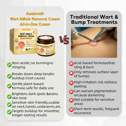 Made and Shipped from Australia ✨Awzlove® Wart & Mole Removal All-in-One Cream 🏆
