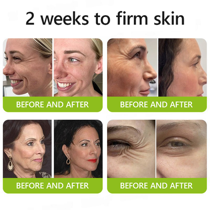 𝗛𝗲𝗮𝗹𝗿𝗶𝘇𝗲® 𝗕𝗼𝘁𝗼𝘅 & 𝗩𝗶𝘁𝗮-𝗔 𝗥𝗲𝘁𝗶𝗻𝗼𝗹 𝗦𝗵𝗼𝘁 𝗪𝗿𝗶𝗻𝗸𝗹𝗲-𝗟𝗶𝗳𝘁 𝗧𝗶𝗴𝗵𝘁𝗲𝗻𝗶𝗻𝗴 𝗰𝗿𝗲𝗮𝗺 - 𝗟𝗮𝘀𝘁 𝗗𝗮𝘆 𝗣𝗿𝗼𝗺𝗼𝘁𝗶𝗼𝗻 𝟴𝟬% 𝗢𝗙𝗙 |🌾🐳 𝗠𝗮𝗱𝗲 𝗮𝗻𝗱 𝘀𝗵𝗶𝗽𝗽𝗲𝗱 𝗳𝗿𝗼𝗺 AU