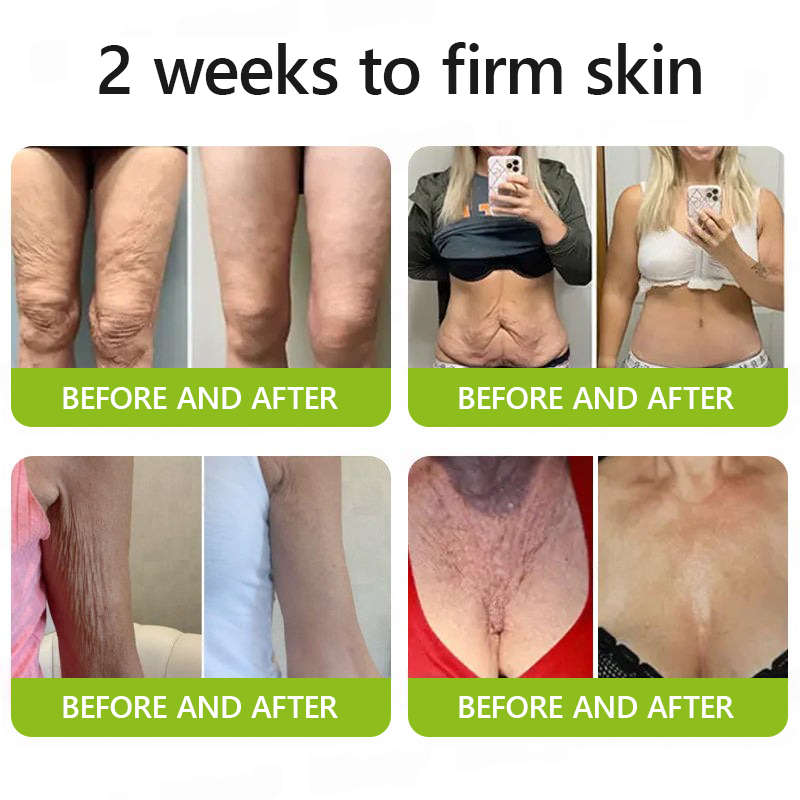 𝗛𝗲𝗮𝗹𝗿𝗶𝘇𝗲® 𝗕𝗼𝘁𝗼𝘅 & 𝗩𝗶𝘁𝗮-𝗔 𝗥𝗲𝘁𝗶𝗻𝗼𝗹 𝗦𝗵𝗼𝘁 𝗪𝗿𝗶𝗻𝗸𝗹𝗲-𝗟𝗶𝗳𝘁 𝗧𝗶𝗴𝗵𝘁𝗲𝗻𝗶𝗻𝗴 𝗰𝗿𝗲𝗮𝗺 - 𝗟𝗮𝘀𝘁 𝗗𝗮𝘆 𝗣𝗿𝗼𝗺𝗼𝘁𝗶𝗼𝗻 𝟴𝟬% 𝗢𝗙𝗙 |🌾🐳 𝗠𝗮𝗱𝗲 𝗮𝗻𝗱 𝘀𝗵𝗶𝗽𝗽𝗲𝗱 𝗳𝗿𝗼𝗺 AU