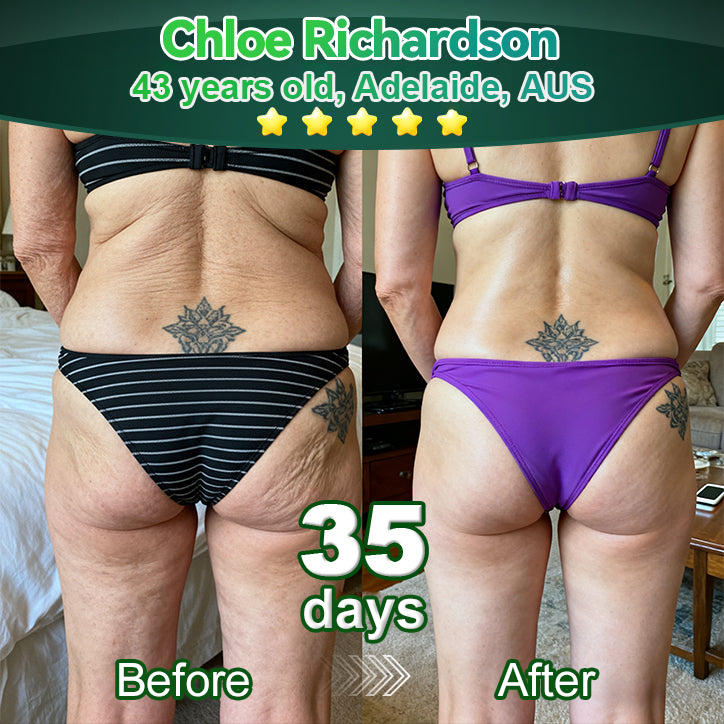 Awzlove® Luxurious Collagen & Stem Cell Anti-Cellulite Massage Oil (🔥70% Off for a Limited Time!)🥑🥑