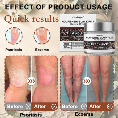 Enjoy 30% OFF for adding the second one |  CareRegen®😍